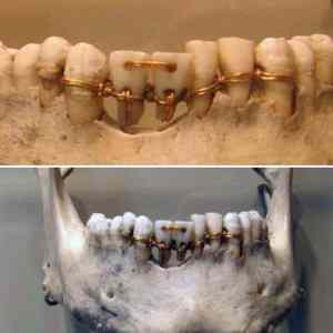 Obrázek '- Ancient Egyptian dental work from 2000 BC -'