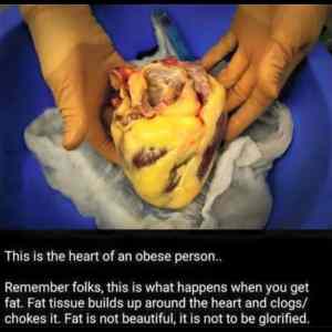 Obrázek 'A Fat Heart'