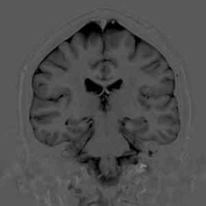 Obrázek 'Alien&nbsp;v&nbsp;hlave'