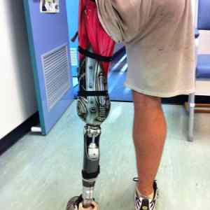 Obrázek 'Fancy Prosthetic Leg Ever'