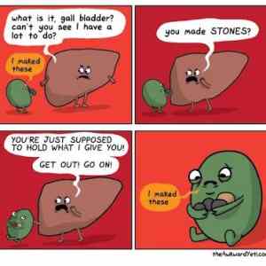 Obrázek 'Kidney stones '