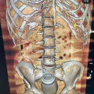 Obrázek 'Nescafe&nbsp;v&nbsp;prdeli'