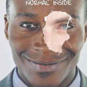 Obrázek 'Normal inside'