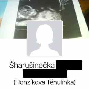 Obrázek 'Rakovina&nbsp;oci'