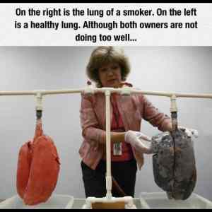 Obrázek 'Smokers Lungs'