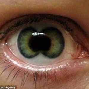 Obrázek 'Two&nbsp;in&nbsp;One&nbsp;Lenses'