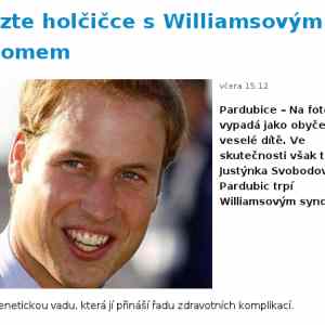 Obrázek 'Williamsuv syndrom'