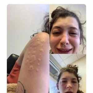 Obrázek 'allergy testing went great '