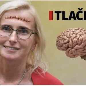 Obrázek 'at netlaci'