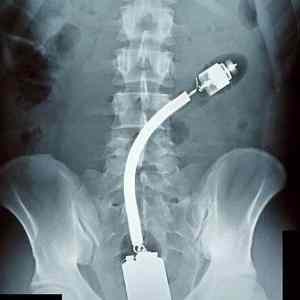 Obrázek 'if-it-fits&nbsp;141'