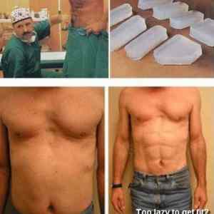 Obrázek 'implantaty'