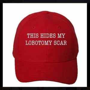 Obrázek 'lobotomy scar'