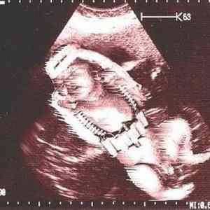 Obrázek 'palestinian sonogram'