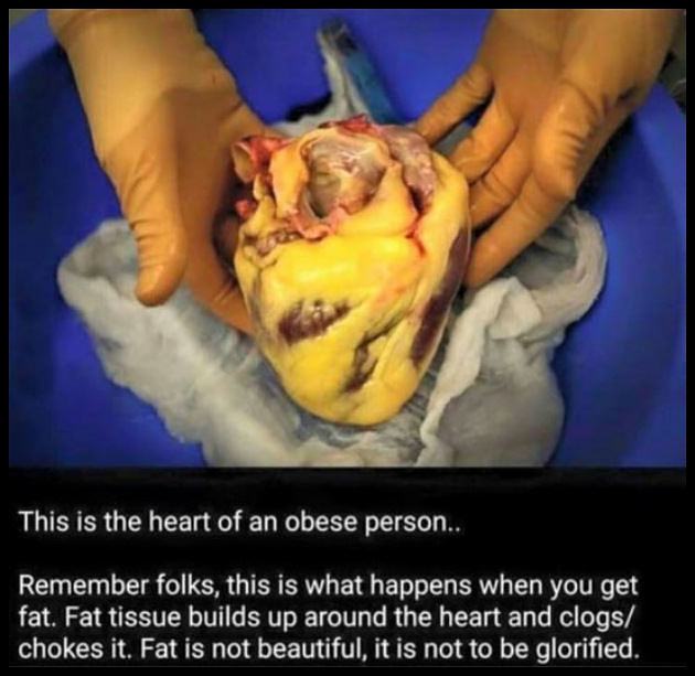 Obrázek A Fat Heart