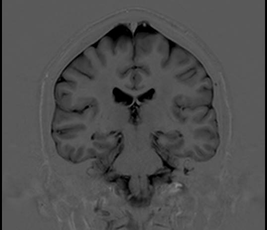 Obrázek Alien v hlave