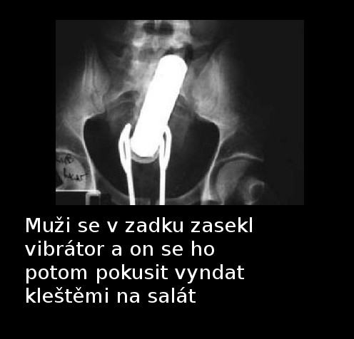 Obrázek Anusovy genius
