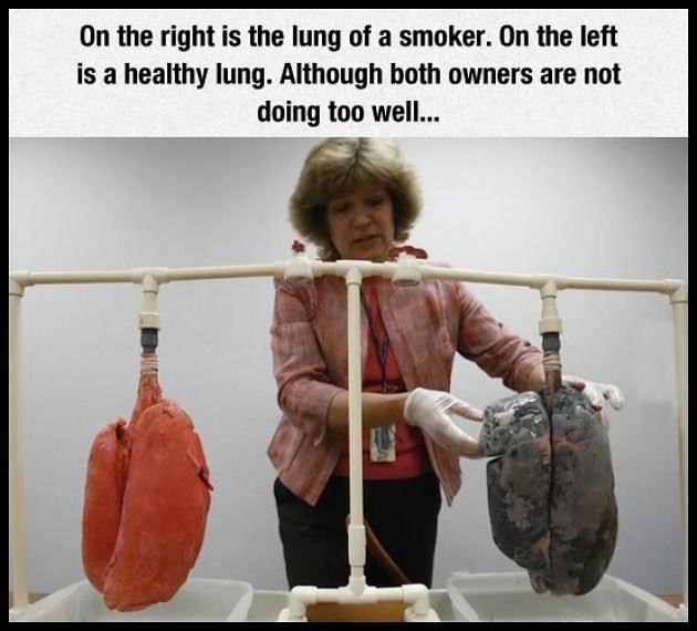 Obrázek Smokers Lungs