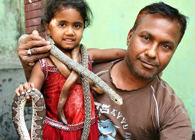 Obrázek The snake man of Bangladesh