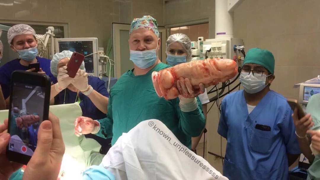 Obrázek To muselo bolet