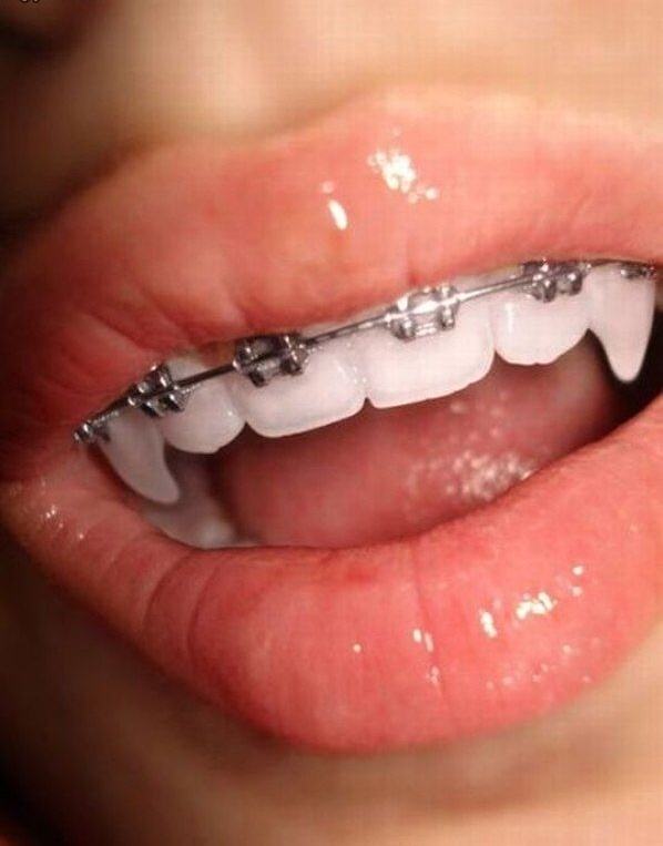 Obrázek Vampire Braces