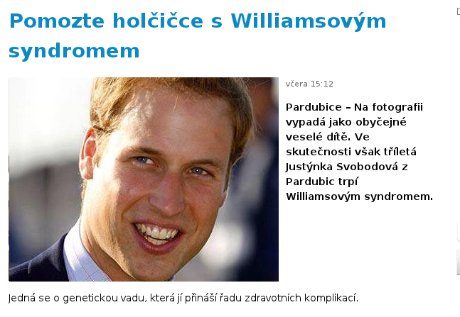 Obrázek Williamsuv syndrom