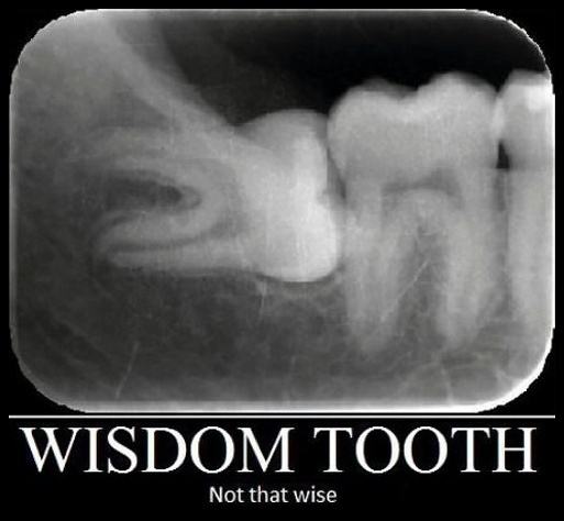 Obrázek Wisdom Tooth