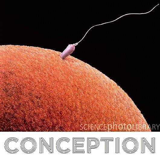 Obrázek X- Conception