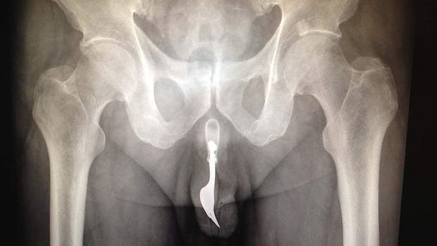 Obrázek X           rays
