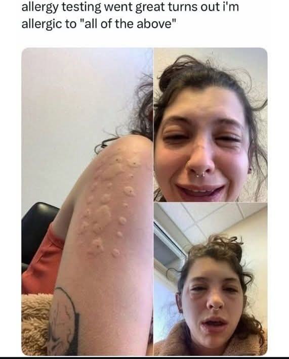 Obrázek allergy testing went great 