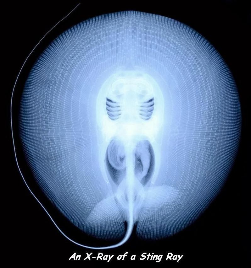 Obrázek an x-ray  