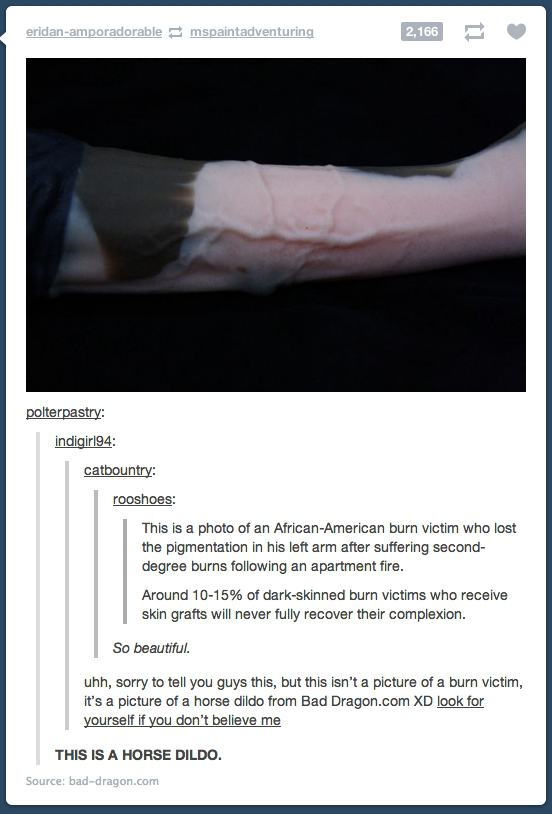 Obrázek burn victim