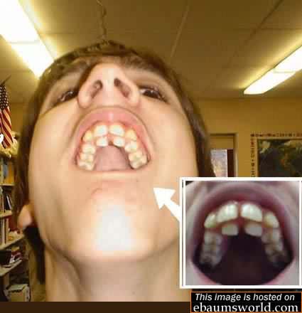 Obrázek doubleteeth