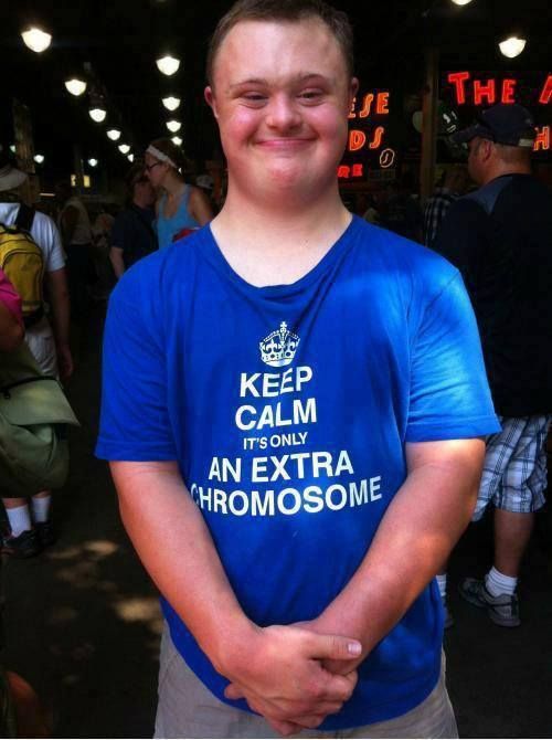 Obrázek extra chromosome