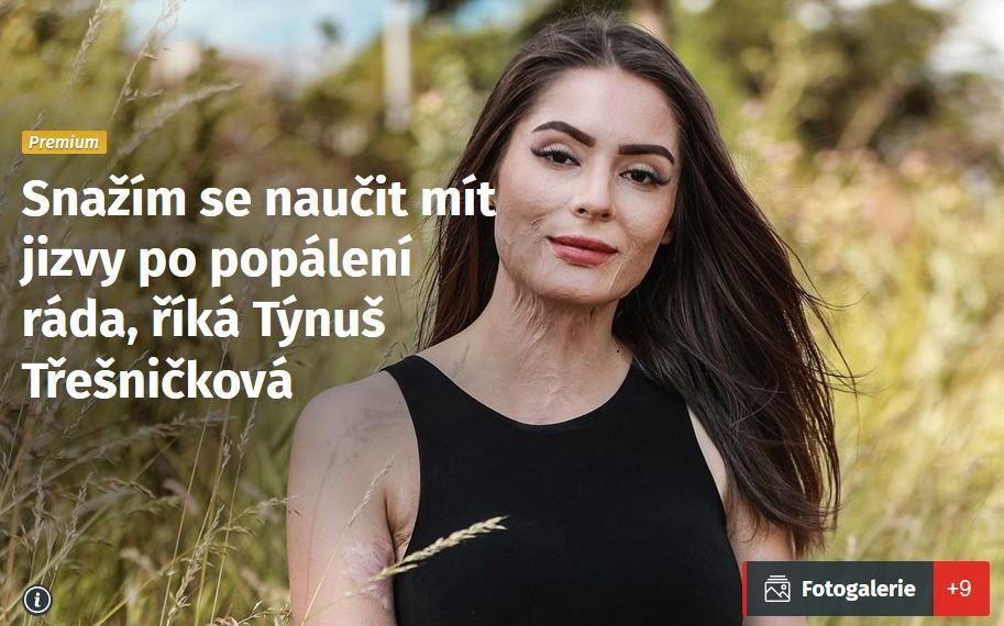 Obrázek kdyz chces cool fotky u flambovani a skonci tim tvoje YT kariera