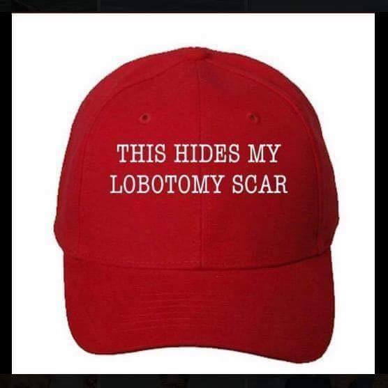 Obrázek lobotomy scar
