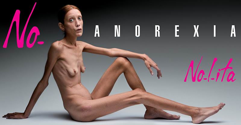 Obrázek no anorexia