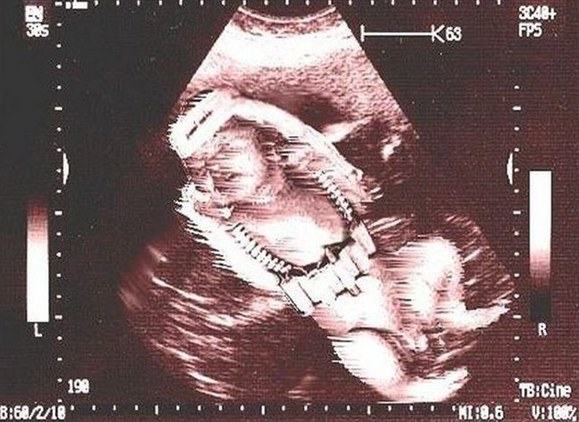 Obrázek palestinian sonogram