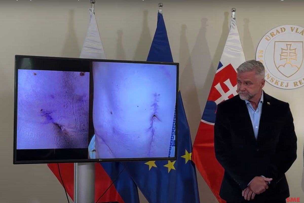 Obrázek predsedove brucho