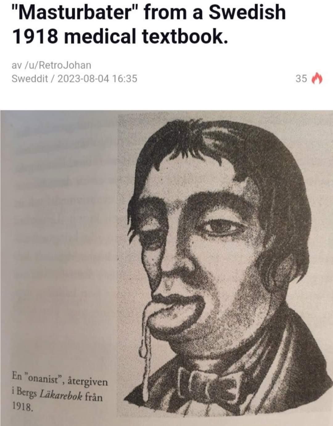 Obrázek roumenista v ucebnici