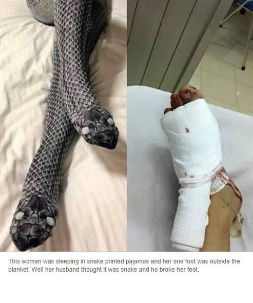Obrázek snake foot