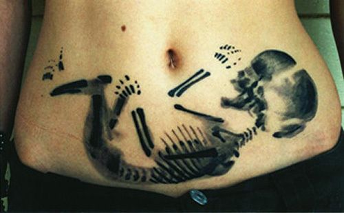 Obrázek tehotensky rentgen