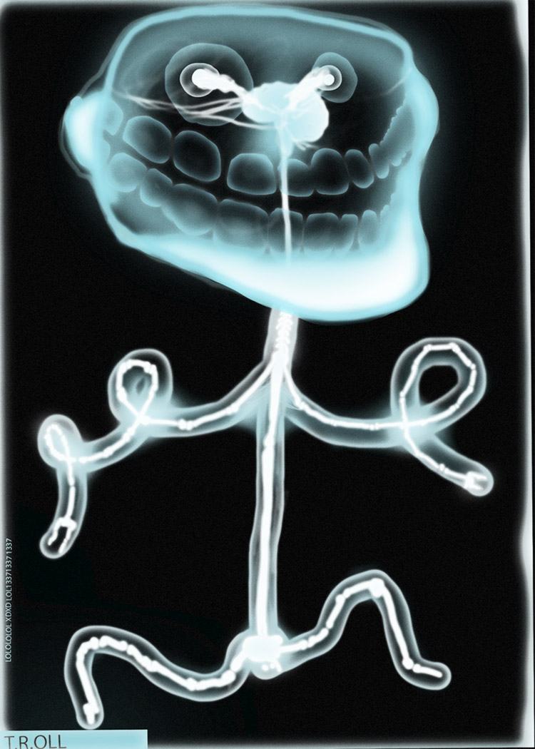 Obrázek troll anatomy