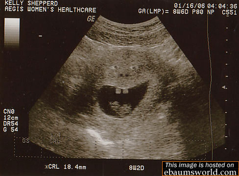 Obrázek ultrasound 189