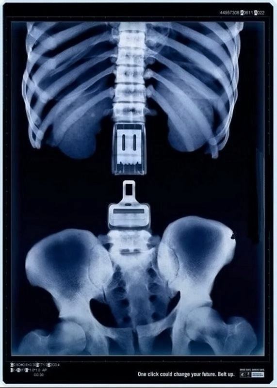 Obrázek x-ray surprise