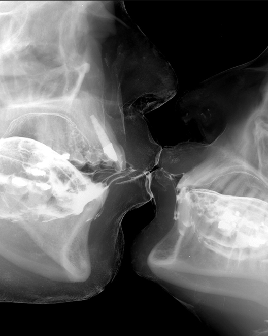 Obrázek x ray kiss