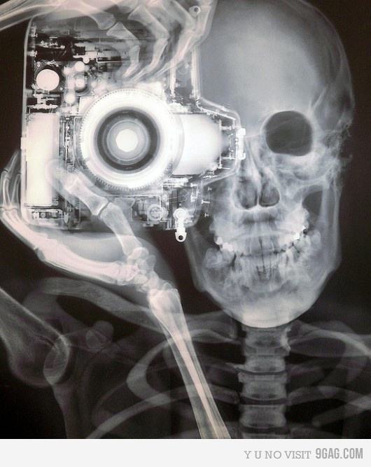 Obrázek xray photo