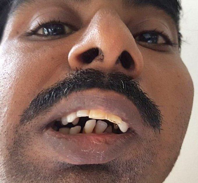 Obrázek Klaisky zvedavec