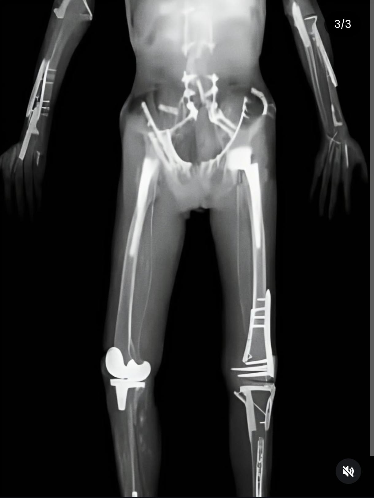 Obrázek Uhodni sport 2ze2